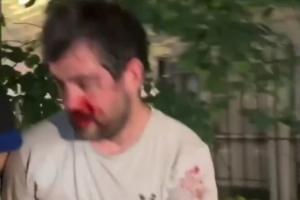 被打出刺籍！“邓肯”惨遭纽约暴徒围攻！满脸鲜血脱球衣求保命